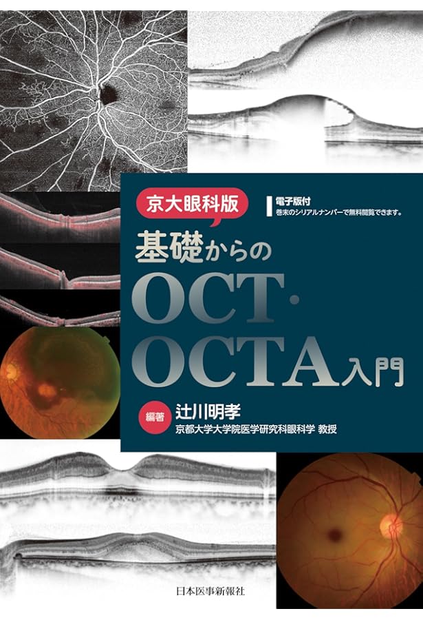 診断力がアップする！OCT・OCTAパーフェクト読影法〜正常・異常所見の