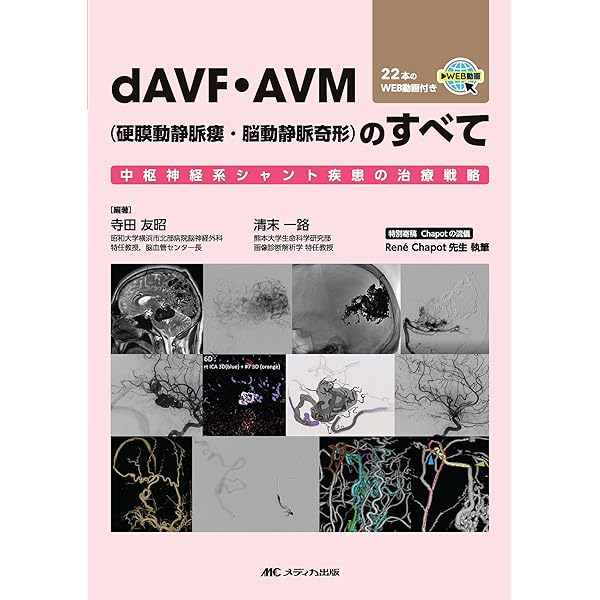 カダバーと動画で学ぶ頭蓋底アプローチ | 井川 房夫 |本 | 通販 | Amazon