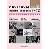 改訂2版 血栓回収療法Technical Tips：治療の引き出しを増やす！／手技