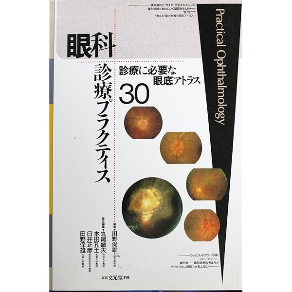 カラーアトラス 眼底図譜 | 湯澤美都子, 川村昭之 |本 | 通販 | Amazon