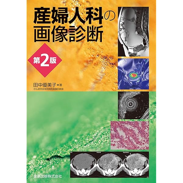 エキスパートのための脊椎脊髄疾患のMRI 第3版 | 柳下 章, 相田 典子