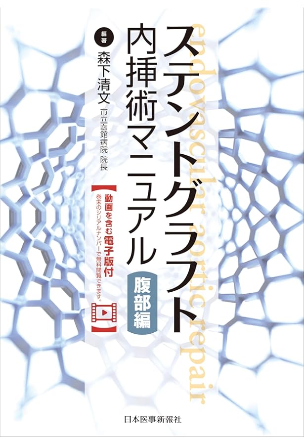 胸部大動脈瘤ステントグラフト内挿術の実際 | 大木隆生, 大木隆生 |本