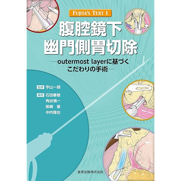 癌研スタイル 腹腔鏡下胃切除術 | 山口 俊晴, 福永 哲, 比企 直樹 |本