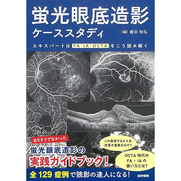 Amazon.co.jp: 黄斑疾患診療AtoZ 第2版 (眼科臨床エキスパート) : 岸