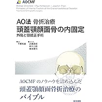 AO法骨折治療 頭蓋顎顔面骨の内固定: 外傷と顎矯正手術 | 下郷和雄
