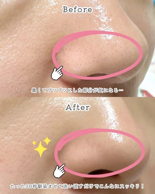 毛穴ケア革命】新作「コスメデコルテ AQ 毛穴美容液オイル」の魅力