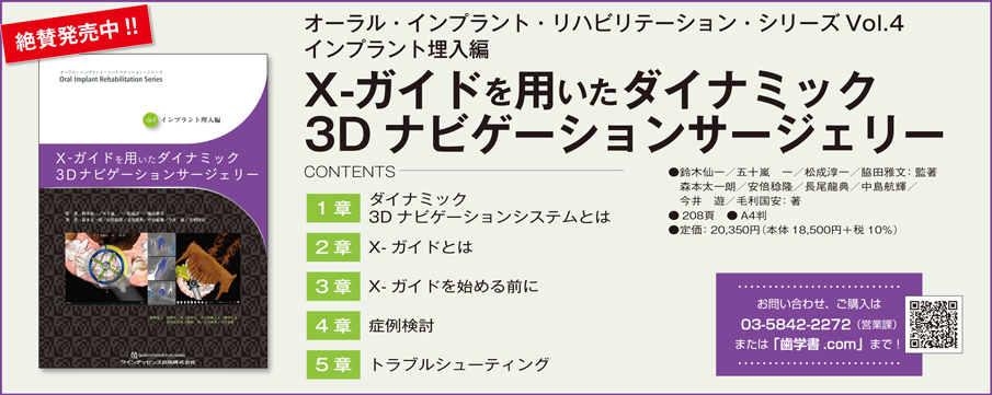 PR】ダイナミック3Dナビゲーションサージェリーは、数年後には主流な術