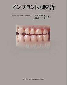 インプラントの咬合 - クインテッセンス出版