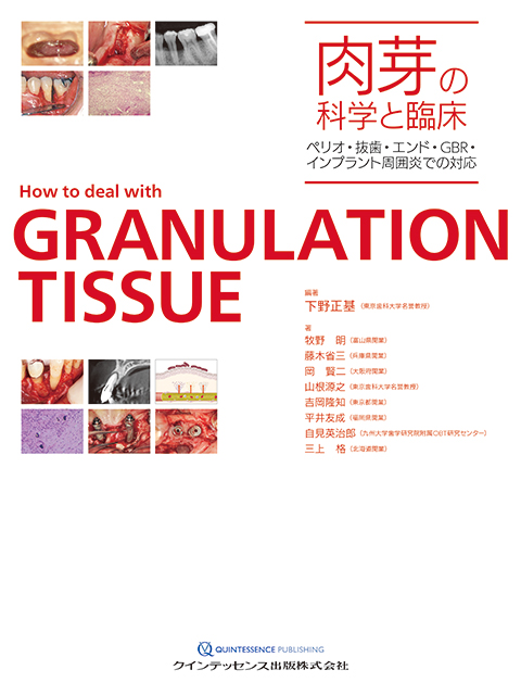 Dr.Hiroのペリオ図鑑 - クインテッセンス出版