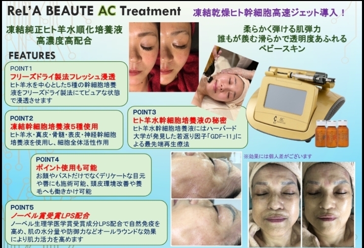 ACトリートメント～凍結乾燥ヒト幹細胞培養液を 最新技術（高速