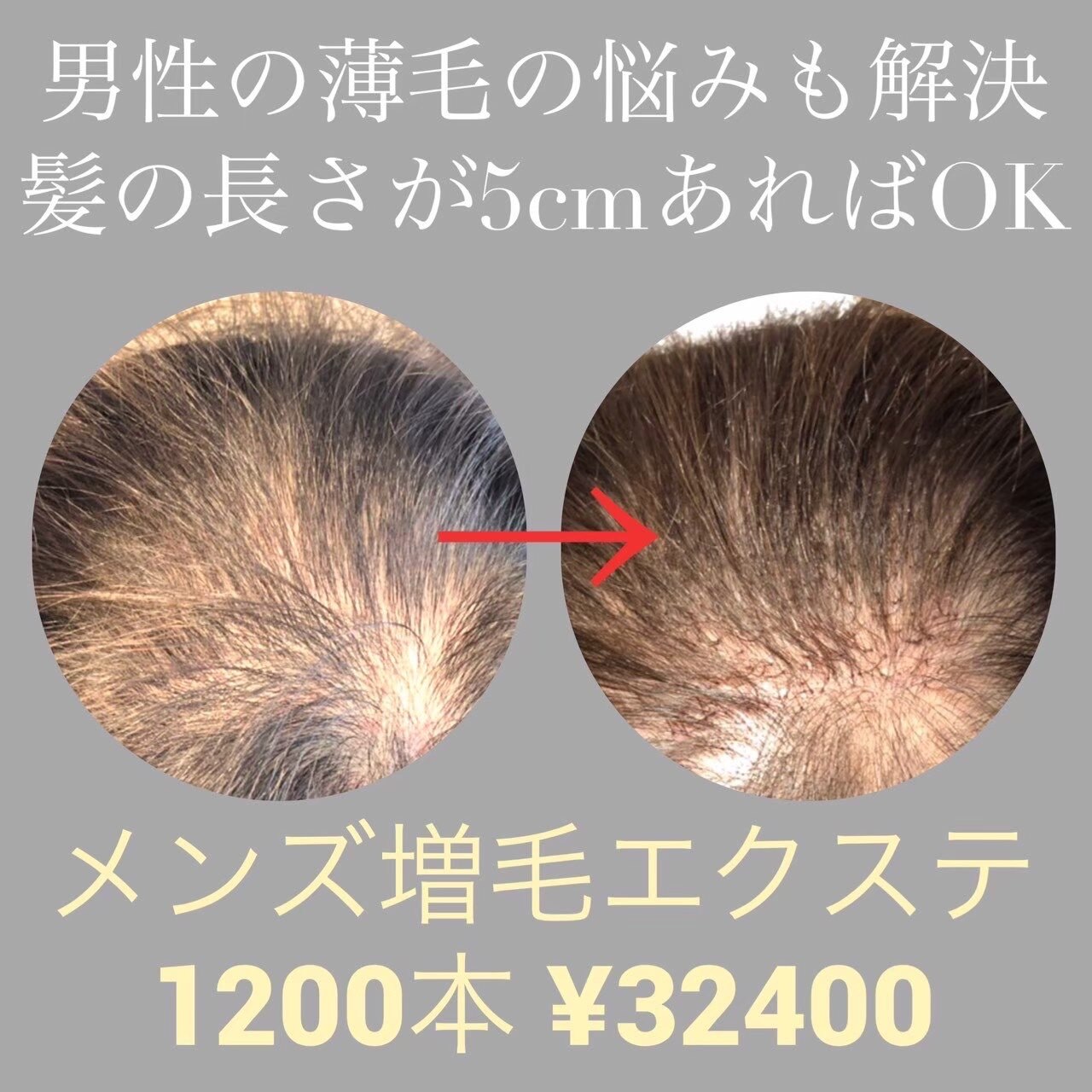 エアエク増毛エクステヘアループ☆1200本！トップのボリュームUP