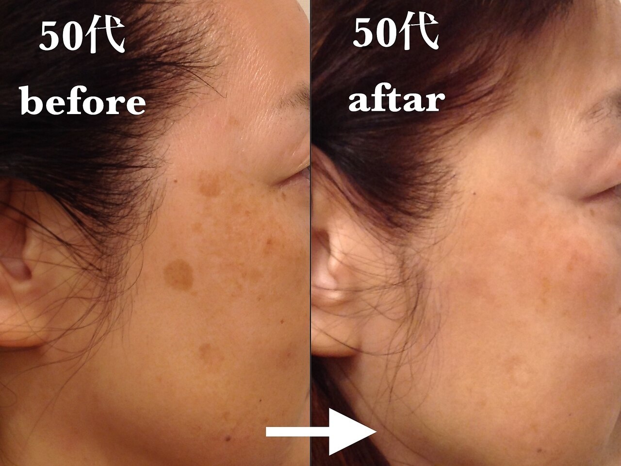 ドクターピュールボーテ 神戸店(Dr. PUR BEAUTE)｜ホットペッパー