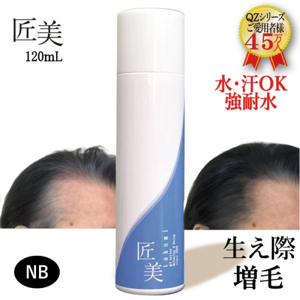 強耐水増毛スプレー「QZーMT匠美 120ml」薄毛隠し 円形脱毛症 増毛