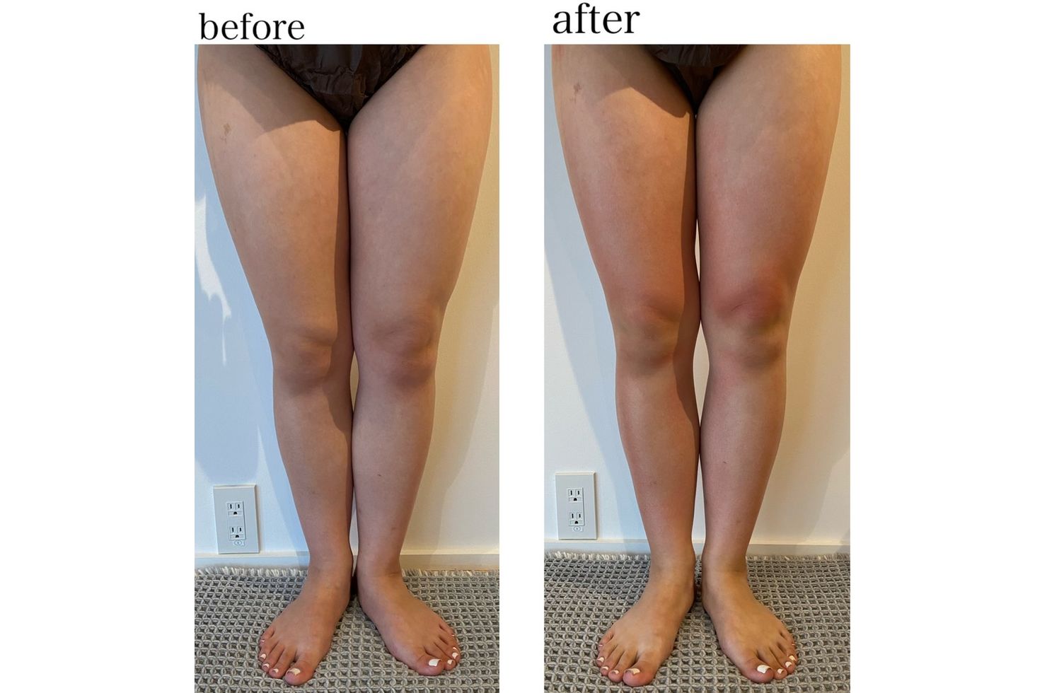 リアムール / エキスパートマックスボディ | 化粧品 | 大阪市のエステ