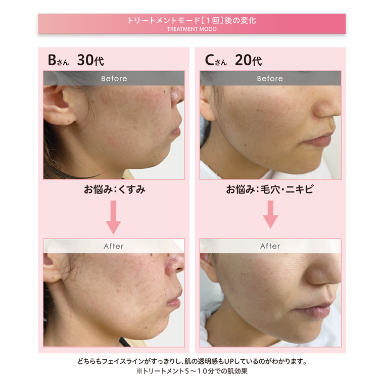 Face Pro(フェイスプロ) | ラミール通販サービス