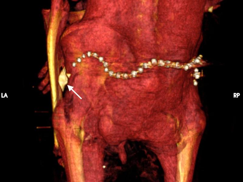 ハイテクスキャナーでミイラを「開封」…35歳で死亡したファラオは健康
