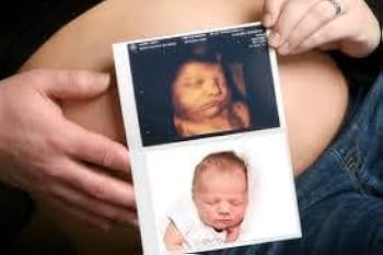 Amazon.co.jp: SONY UPC-21L Lサイズカラープリントパック : 産業