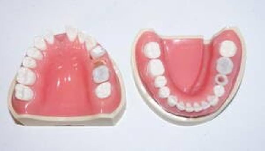 Amazon.co.jp: 歯科 模型 ニッシン 顎模型 根管治療 エンド NISSIN