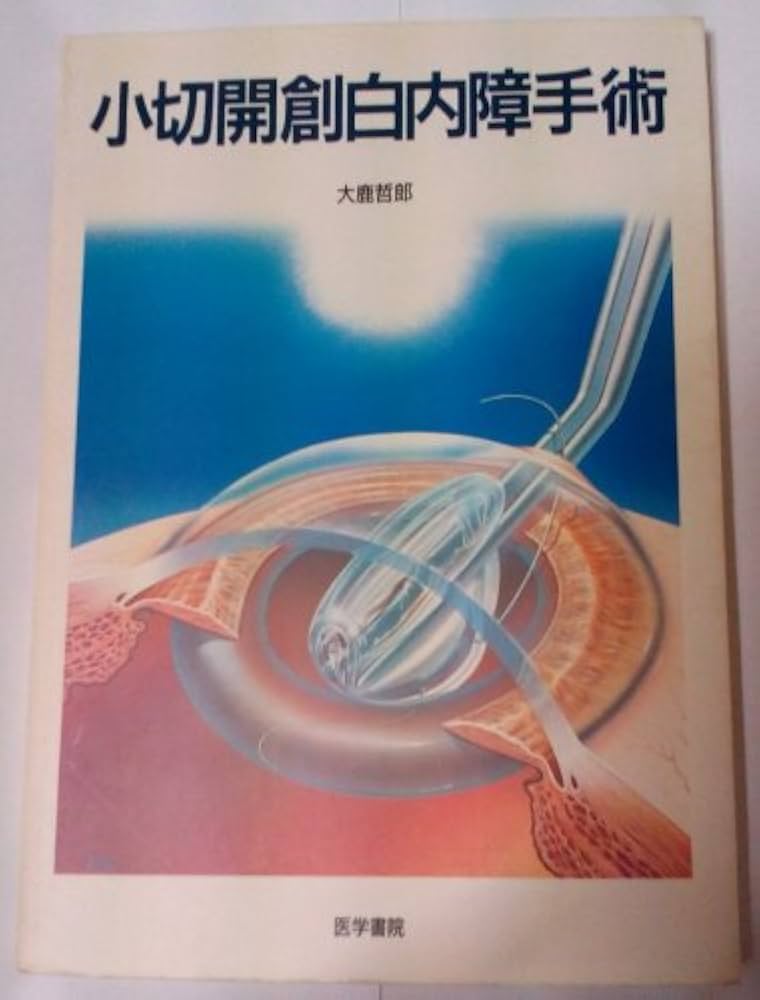 Amazon.co.jp: 小切開創白内障手術 : 本