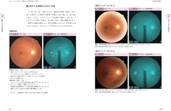健診のための眼底検査 改訂版〜無散瞳カメラによる撮影と判定〜 (手に