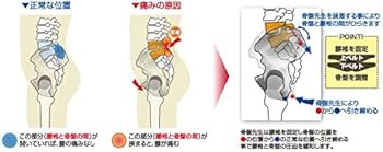 Amazon.co.jp: SKP整体が作った骨盤先生こつばんせんせい 骨盤用ベルト