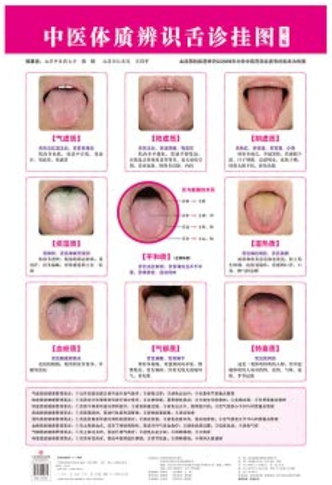 Amazon.co.jp: S中医体质辨识舌诊挂图 第2版 第二版 辩证图谱完全图解