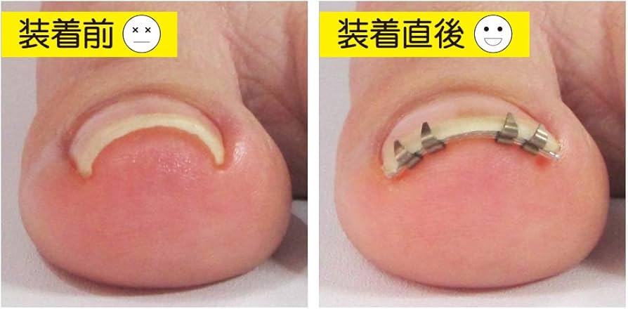 Amazon.co.jp：JPS(ジェイピーエス) まきづめリフト(ヤスリ付き) ML4SF