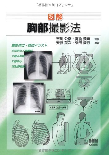 図解 胸部撮影法 | 安藤 英次, 柴田 善行, 吉川 公彦, 高倉 義典, 吉川