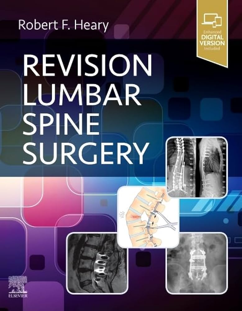 Revision Lumbar Spine Surgery: 9780323712019: Medicine & Health
