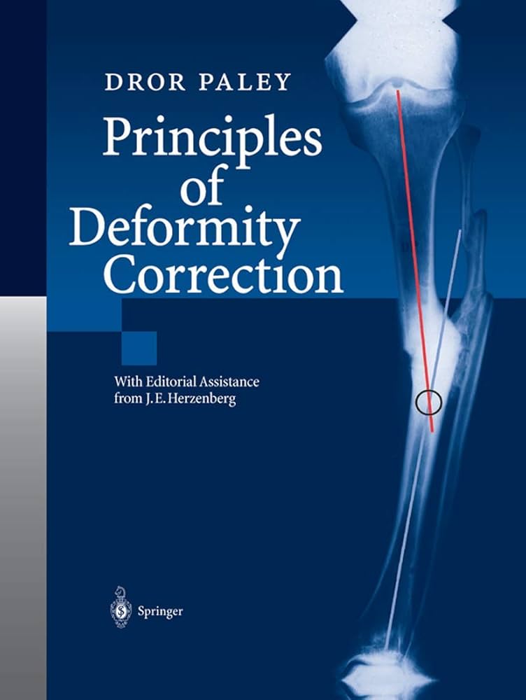 Principles of Deformity Correction: 9783642639531: Medicine