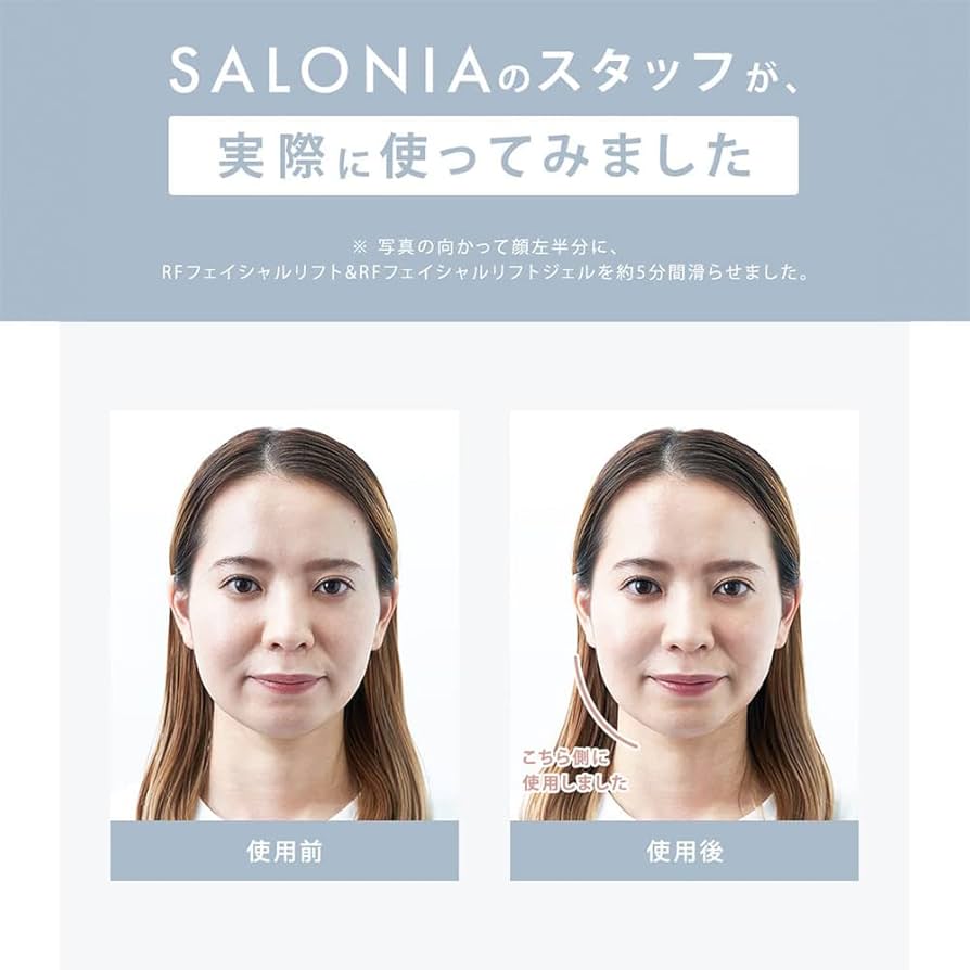 Amazon.co.jp: SALONIA(サロニア) RF フェイシャルリフト 【単品