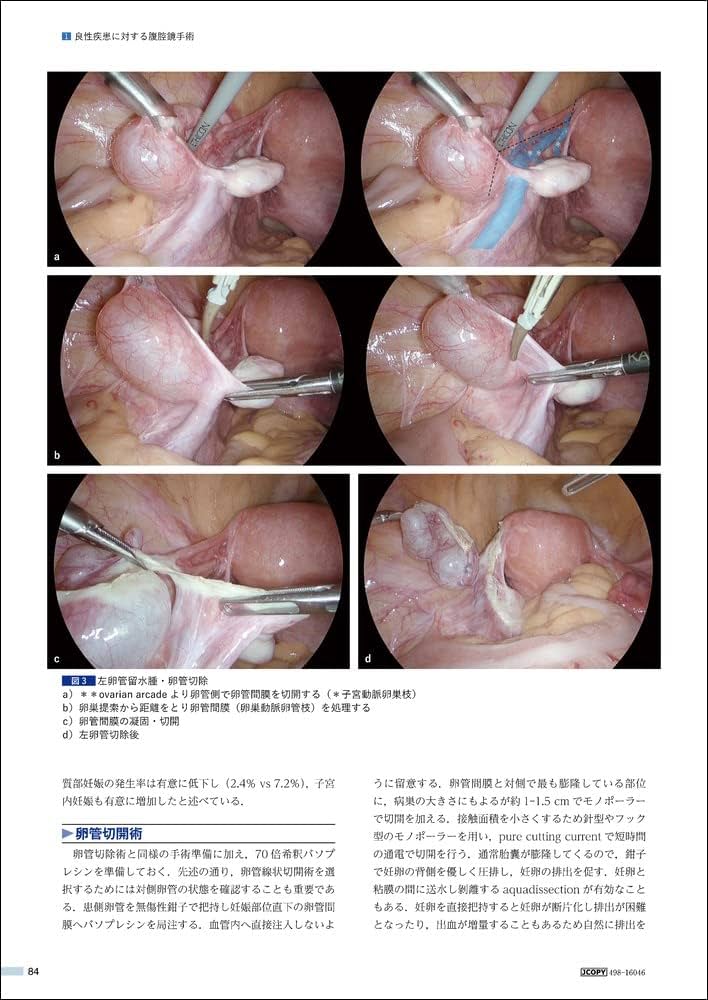 婦人科腹腔鏡手術学 The Kurashiki Method | 安藤 正明, 菅野 潔 |本