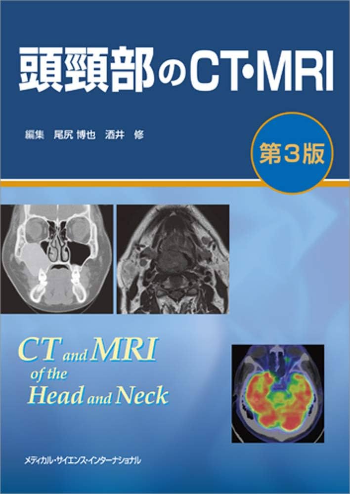 頭頸部のCT・MRI 第3版 | 尾尻博也, 酒井 修 |本 | 通販 | Amazon