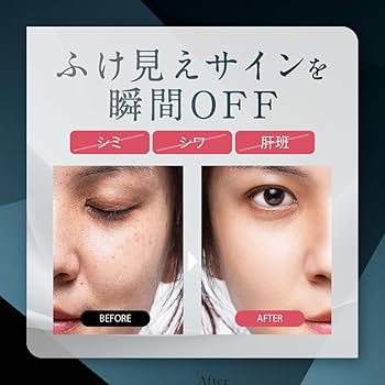 Amazon | NNEファンデーション [ ニードルファンデ 針ファンデ