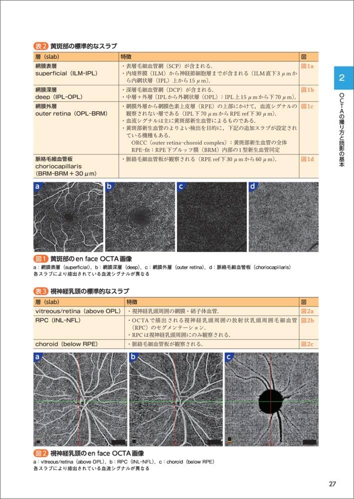 診断力がアップする！OCT・OCTAパーフェクト読影法〜正常・異常所見の