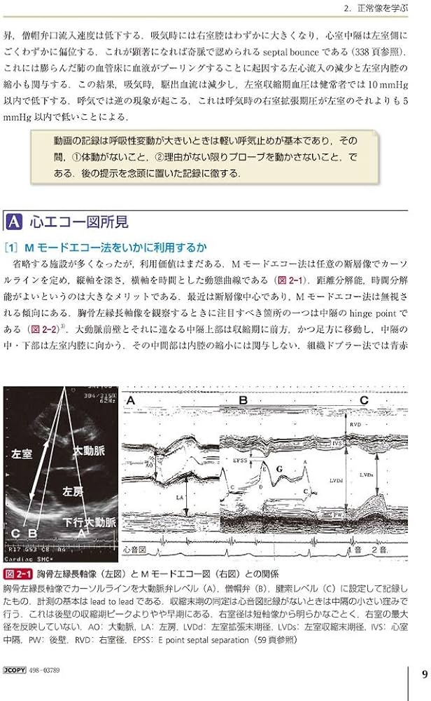 新・心エコーの読み方，考え方 改訂4版 | 羽田 勝征 |本 | 通販 | Amazon