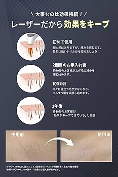 Amazon | トリア Tria パーソナルレーザー脱毛器プレシジョン レーザー