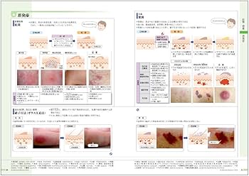 病気がみえる vol.14 皮膚科 第1版 | 医療情報科学研究所 |本 | 通販