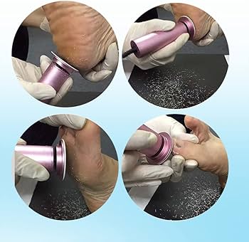 Amazon.co.jp: かかと 角質取り 電動角質リムーバー 電気フット