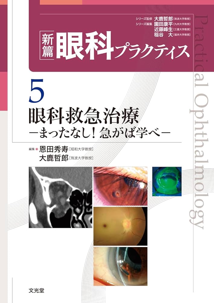 眼科救急治療 -まったなし!急がば学べ- (新篇眼科プラクティス) | 恩田