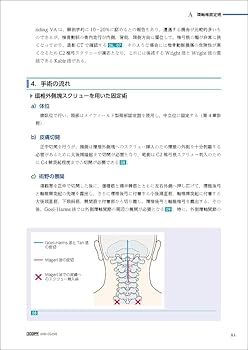 脊椎・脊髄外科マニュアル | 寳子丸 稔, 上田 茂雄 |本 | 通販 | Amazon