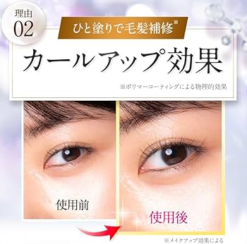 Amazon.co.jp: 【美容クリニック共同開発】ベルフラッシュ Belflash
