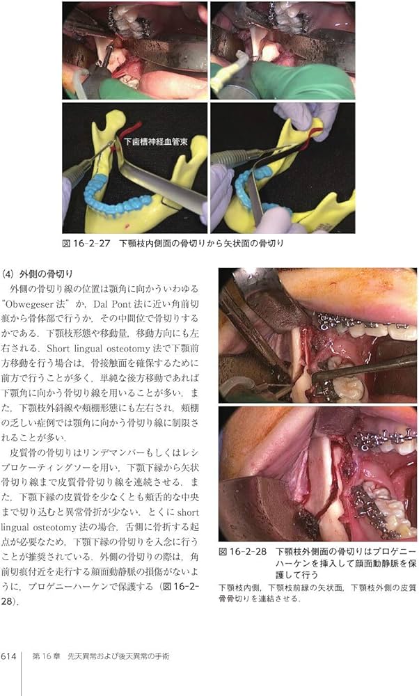 裁断済】口腔外科学 第4版 カラーアトラス サクシンクト口腔外科学 (第