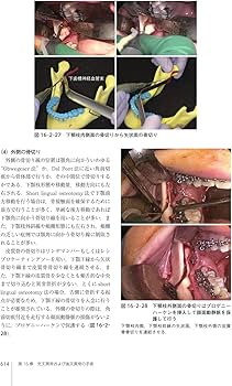 716ZxJtYgtL._AC_UF350,