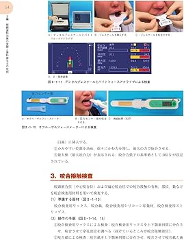 咀嚼障害・咬合異常1 歯科補綴 第2版 (最新歯科衛生士教本) | 全国歯科