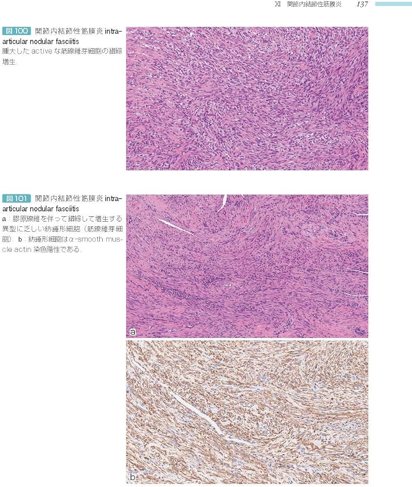 71w8XIJHQ9L._AC_UF1000,