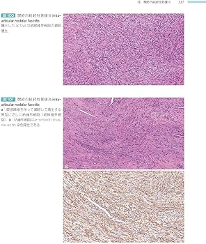 骨関節 (非腫瘍性疾患病理アトラス) | 石田 剛, 今村哲夫 |本 | 通販