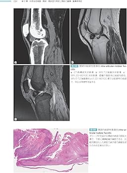 骨関節 (非腫瘍性疾患病理アトラス) | 石田 剛, 今村哲夫 |本 | 通販