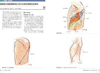 心臓血管外科手術基本手技 (心臓血管外科手術エクセレンス) | 坂東 興