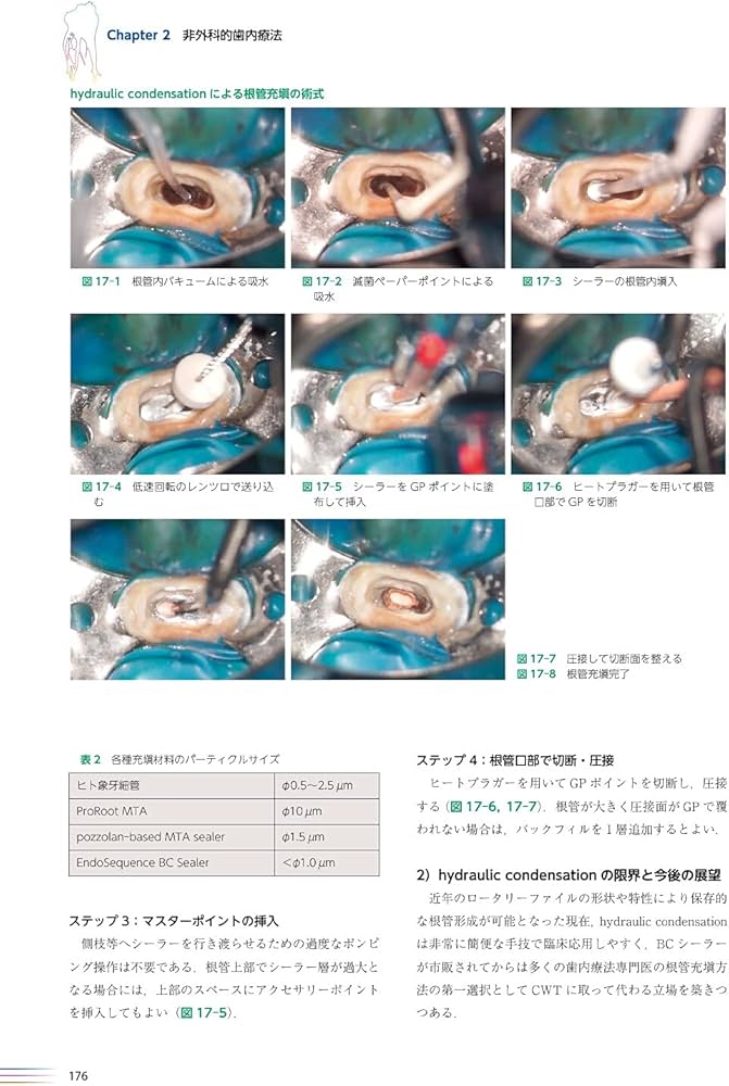 世界基準の臨床歯内療法 第2版 | 石井 宏, 石井 宏 |本 | 通販 | Amazon